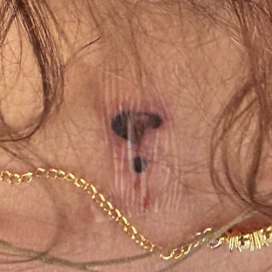 Crystal Adair-Benning’s fine-line interrobang tattoo on the back of her neck